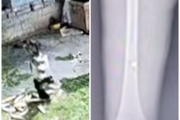 貴州6歲女孩引爆手榴彈 彈片嵌入腿骨