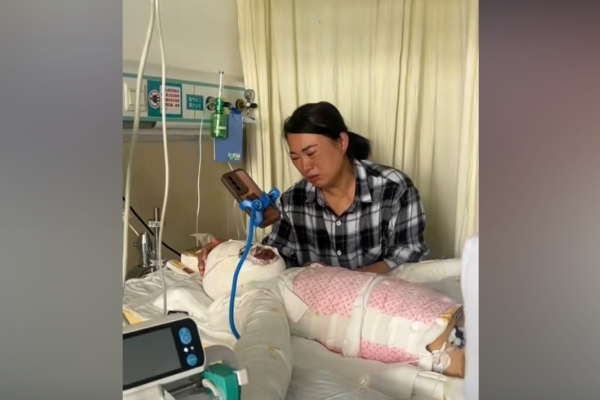 河南8歲女孩開燈引發煤氣爆炸 身體58%燒傷