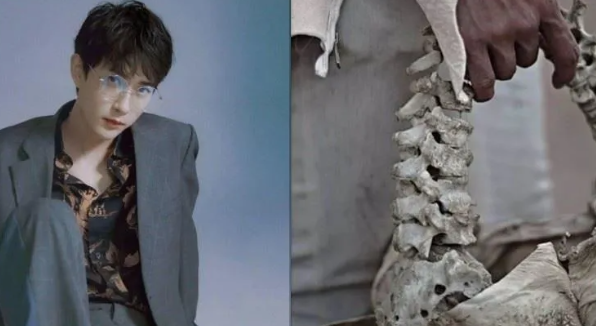 于朦胧案揭人体产业链!富二代「人骨包」再被挖 网轰:骨头来源不敢讲